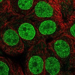 TETRAN Antibody, Novus Biologicals 0.1mL; Unlabeled:Antibodies, Polyclonal